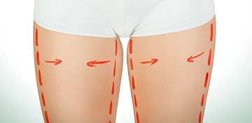 İç Bacak Eritme Yolları